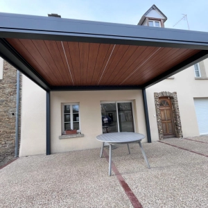 Pose d'une pergola avec lames orientables dans la Manche