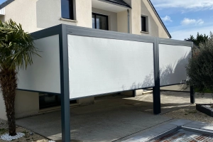 Installation d’une magnifique pergola près de Caen