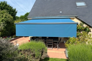 Installation d’un store banne sur la côte fleurie